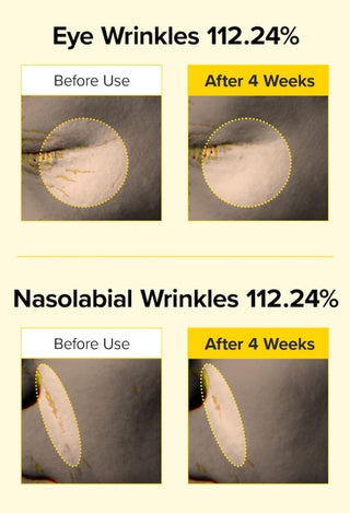 Spicule Retinol PDRN Cream