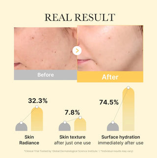 Kojic Acid Turmeric Brightening Gel Mask