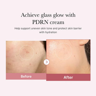 PDRN Pink Hyaluronic Moisturizing Cream