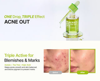 PURITO SEOUL Azelaic Acid 10 Kojic Tea Tree Serum