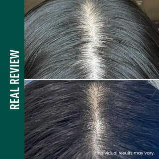 Revive Therapy  Hair Scalp & Brow Ampoule