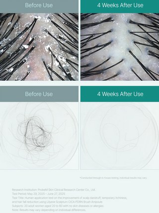lilyeve Scalp:Turn CICA PDRN Brush Ampoule